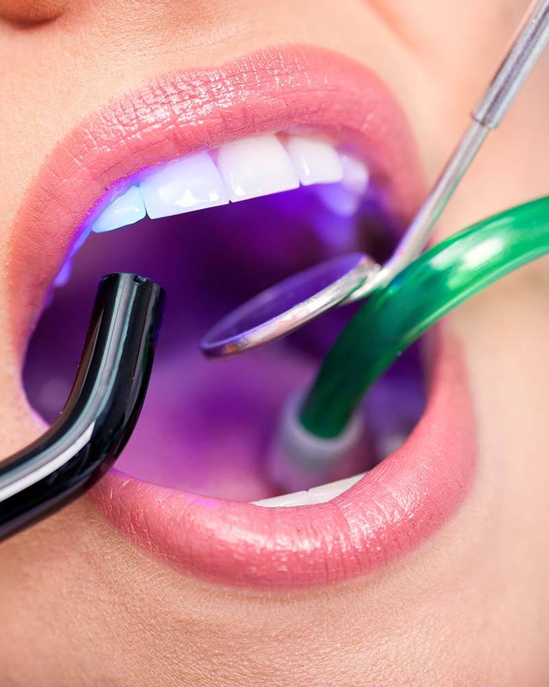 closeup image of patient being treated by dental hygienist
